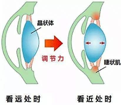 假性近视眼该怎么治疗