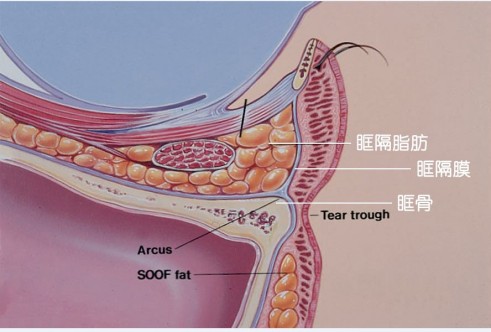 眼袋是怎样形成的？