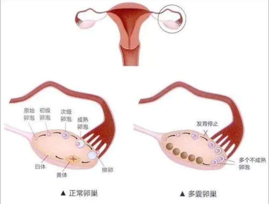 郑州怀八胞胎女子仅18岁，事件的背后有何隐情？