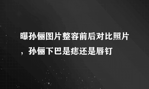 曝孙俪图片整容前后对比照片，孙俪下巴是痣还是唇钉