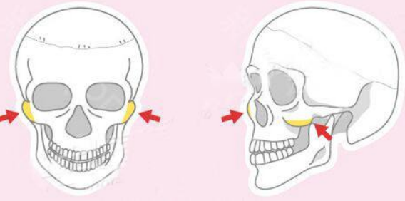 颧骨是哪里啊
