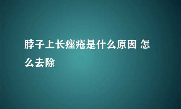 脖子上长痤疮是什么原因 怎么去除