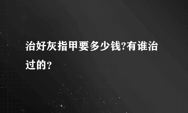 治好灰指甲要多少钱?有谁治过的？