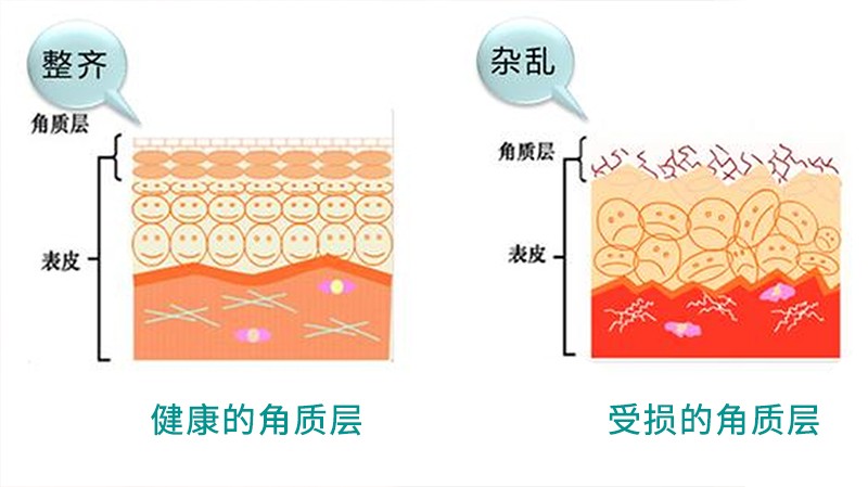 什么可以修复角质层