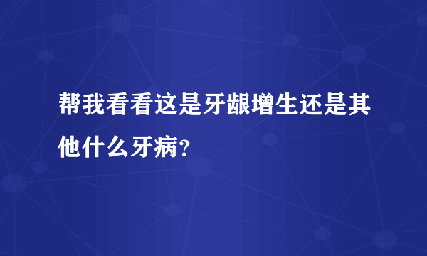 帮我看看这是牙龈增生还是其他什么牙病？