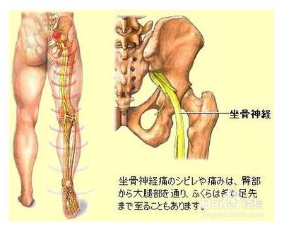 坐骨神经是在人体的哪个部位？