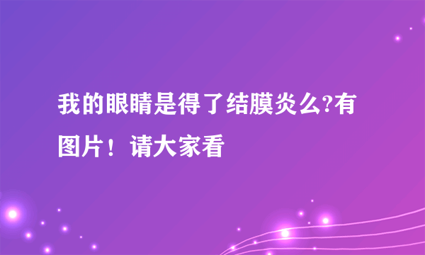 我的眼睛是得了结膜炎么?有图片！请大家看