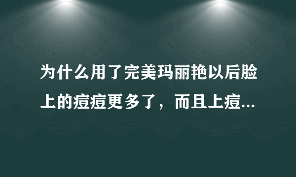 为什么用了完美玛丽艳以后脸上的痘痘更多了，而且上痘痘的地方都是之前最容易长痘痘的地方，以前不长痘的