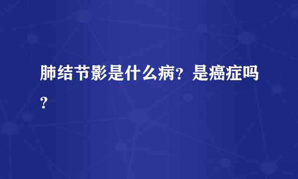 肺结节影是什么病？是癌症吗?